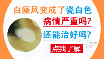 脸部有大面积白癜风去邢台哪治疗效果好”