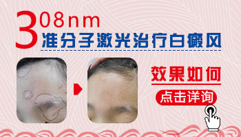 脖颈长小面积白癜风去承德哪看能治好