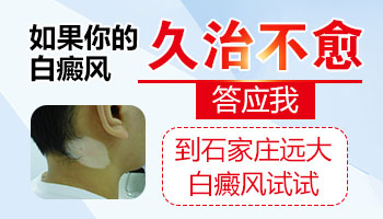 腰部有大面积白癜风去保定哪治疗能治好”
