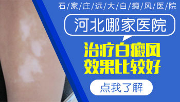 脖颈长小面积白癜风去河北哪看比较好