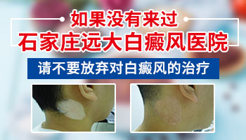 脖颈有米粒大白癜风去邯郸哪看效果好