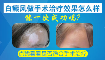 脖颈有泛发型白癜风去邢台哪治疗能治好