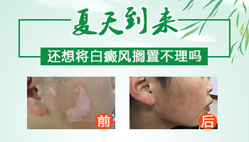 张家口哪家医院治疗白癜风费用更低