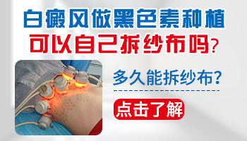 身上有泛发型白癜风去邢台哪治疗能治好