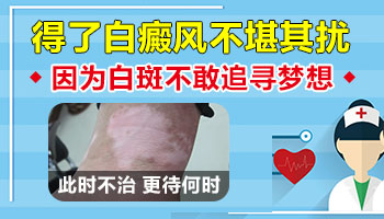 廊坊哪家医院治疗好白癜风正规 花钱少