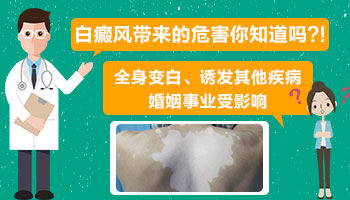脸部有早期白癜风去石家庄哪治疗比较好”