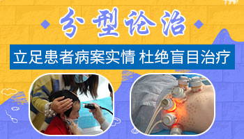 腿部长小面积白癜风去石家庄哪看比较好”