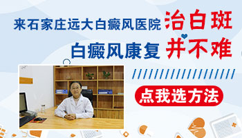 wood灯怎样诊断白斑是白癜风吗