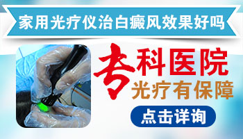 腰部长白癜风去石家庄哪看比较好