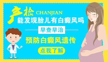 脸部长硬币大白癜风去石家庄哪治疗效果好”