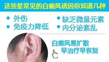 后背有泛发型白癜风去保定哪治疗比较好”