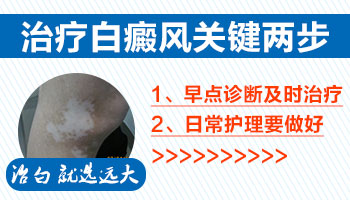 腹部有早期白癜风去邢台哪看比较好