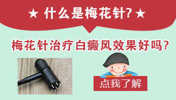 腰部长硬币大白癜风去邢台哪治疗比较好