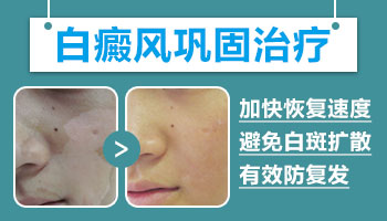 儿童脸上出白块中西医结合治疗怎么样”