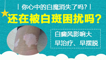 腿部有泛发型白癜风去邢台哪看能治好