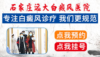 腹部有大片白癜风去石家庄哪治疗能治好