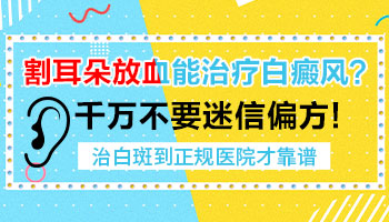 脸部有早期白癜风去石家庄哪治疗效果好