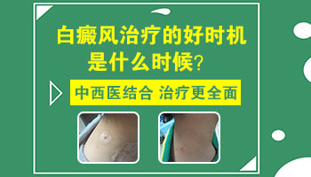 后背长白癜风去邢台哪看能治好