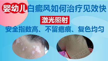 儿童脸上出白块照完308红多久是正常的